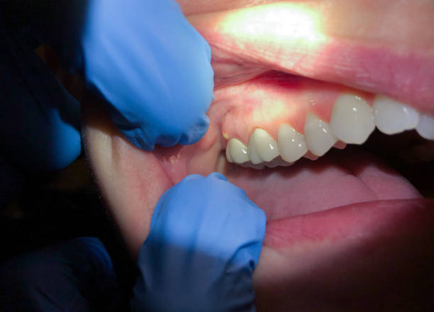 Best Pediatric Emergency Dentist in West Perrine, FL